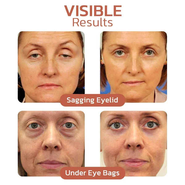 【HORKÝ VÝPRODEJ 79%】 Krém na ošetření a opravu očního krému s krokodýlím olejem