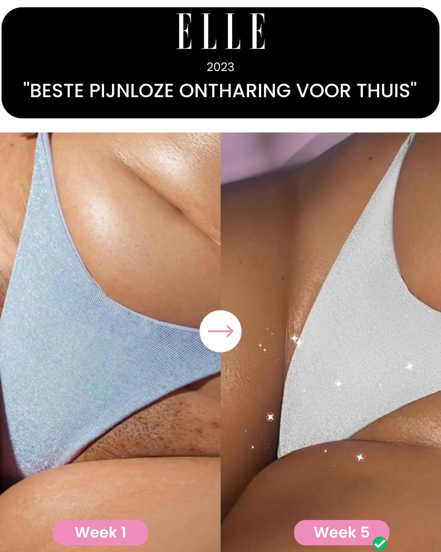 PERMANENTNÍ EPILÁCE NA CELÉ TĚLO