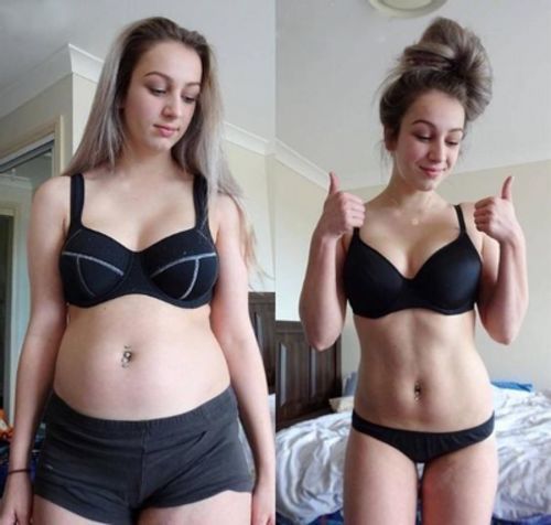 DOPRAVA ZDARMA AFIZTM TURMALÍNOVÁ ZDRAVOTNÍ PONOŽKA NA HUBNUTÍ LYMFY