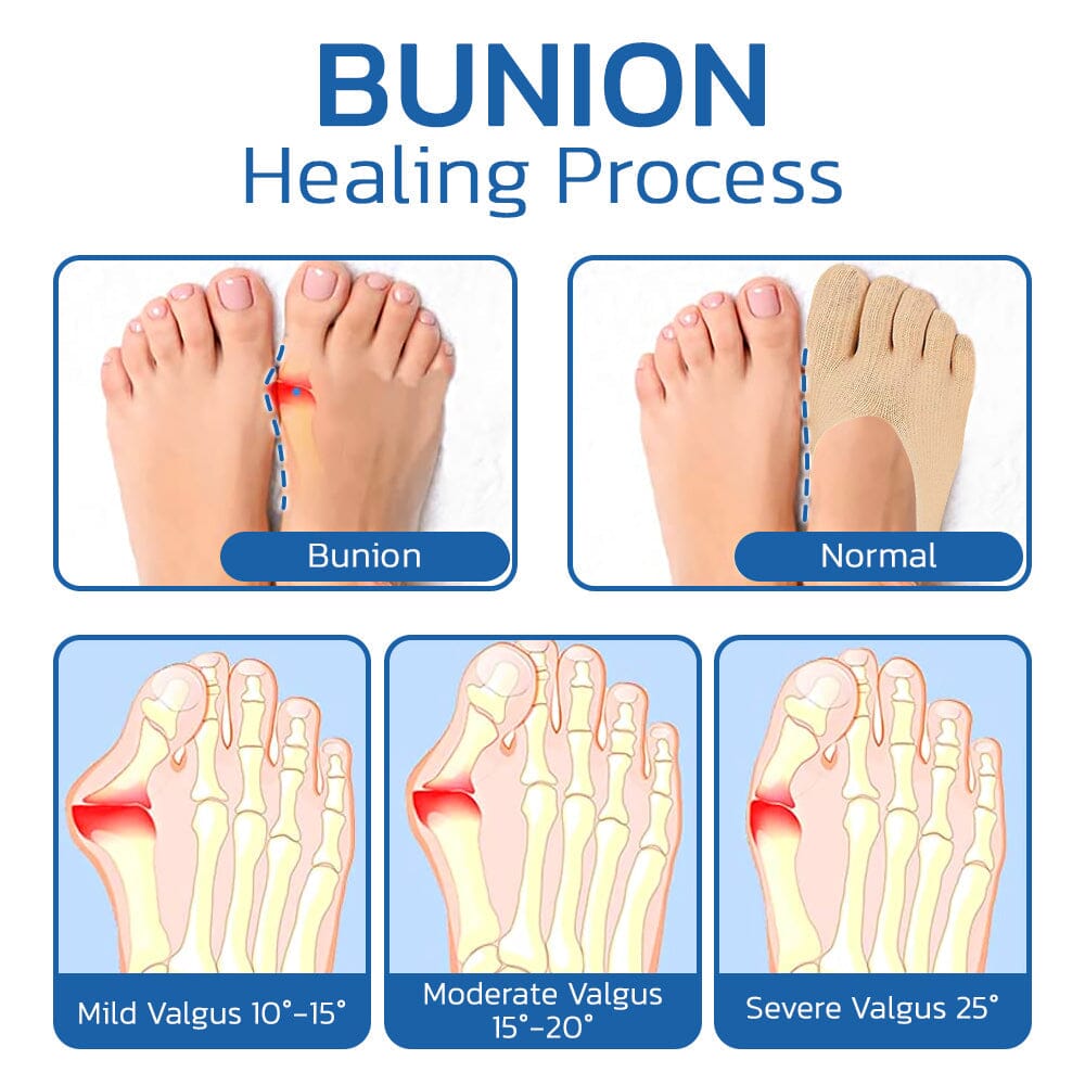 Projoint AntiBunions Sanitární ponožka